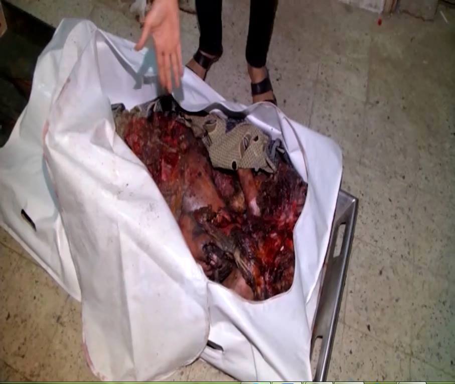 #OnThisDay&nbsp; The Saudi-led,US-BRITISH-BACKED coalition bombed a market, homes, and a school