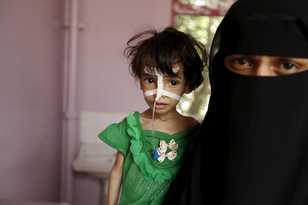 Daily reminder of the genocide committed by the Saudi-led, US-BRITISH-BACKED coalition