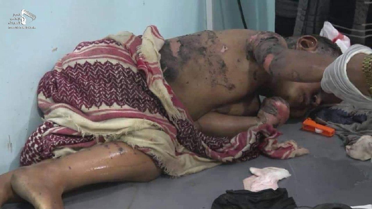#OnThisDay The Saudi-led, US-BRITISH-BACKED coalition bombed weddings, homes, farms