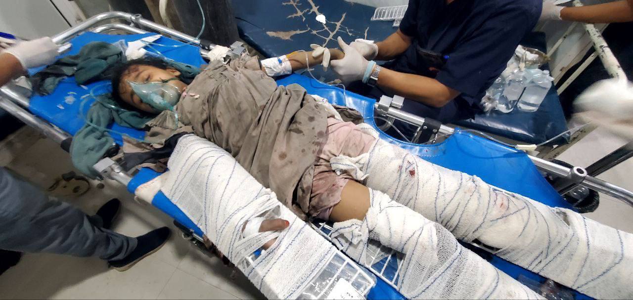 US-British airstrikes kill at least 31 in Yemen
